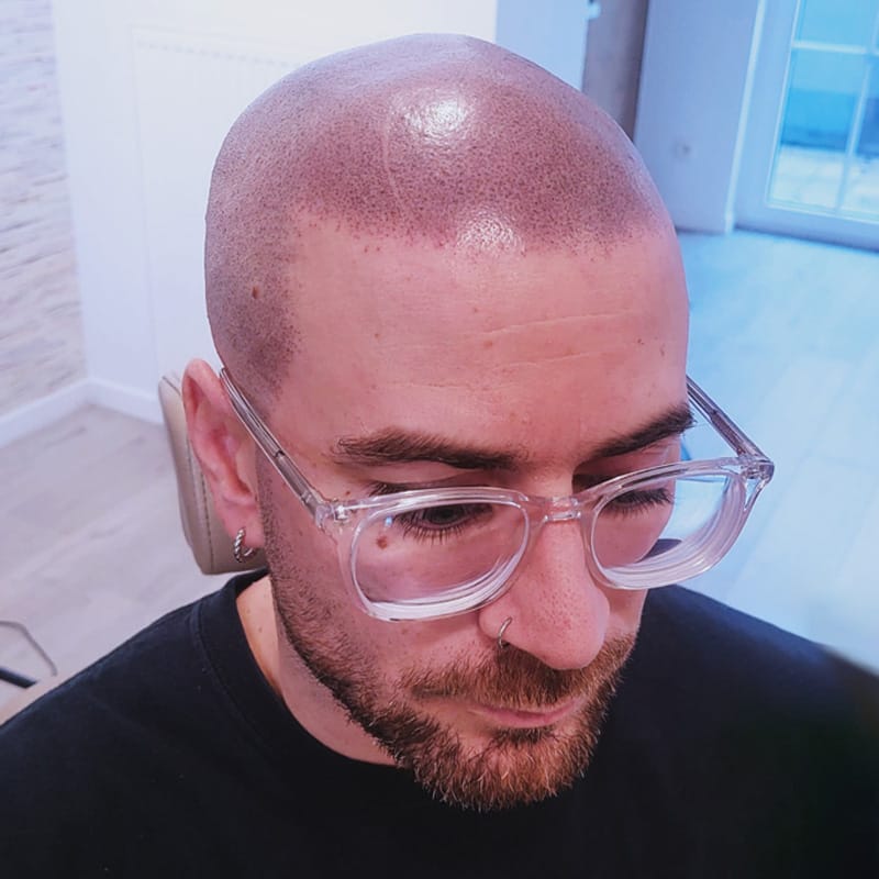 Centre_Micropigmentation-Effet-Rase-header