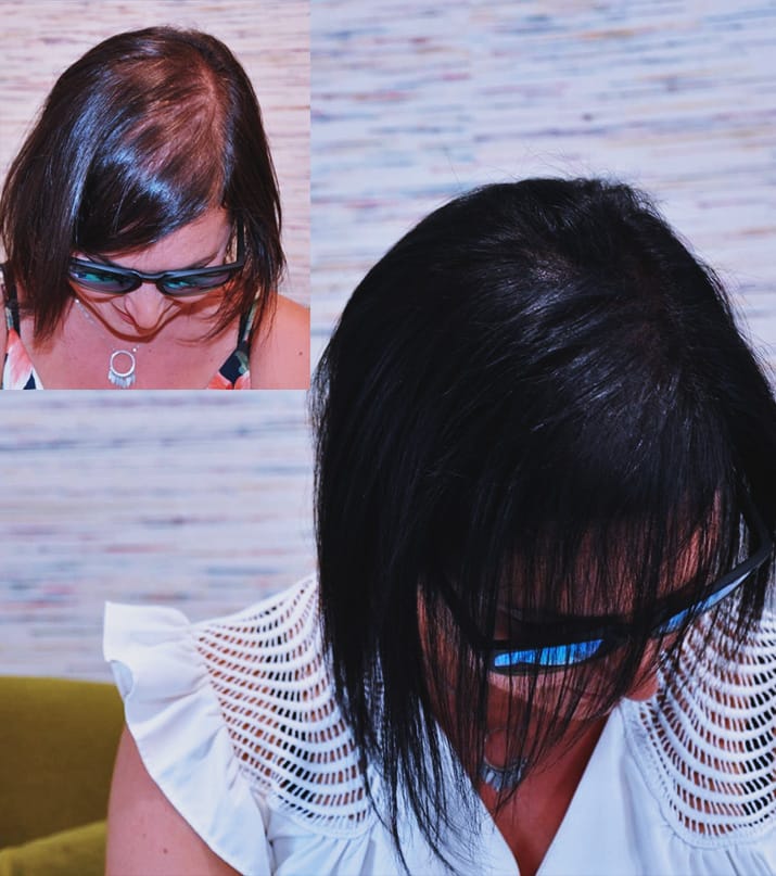 Centre_Micropigmentation-Home-Micropigmentation-realisations-9