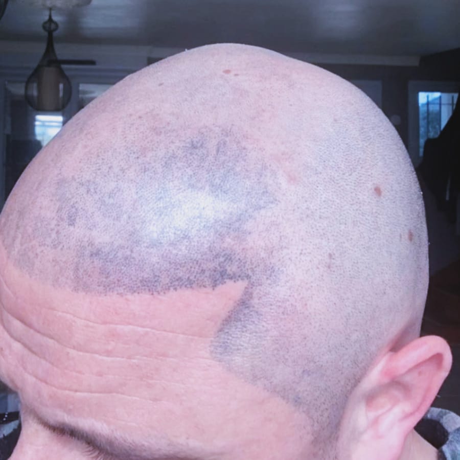 Centre_Micropigmentation-Reparation-header